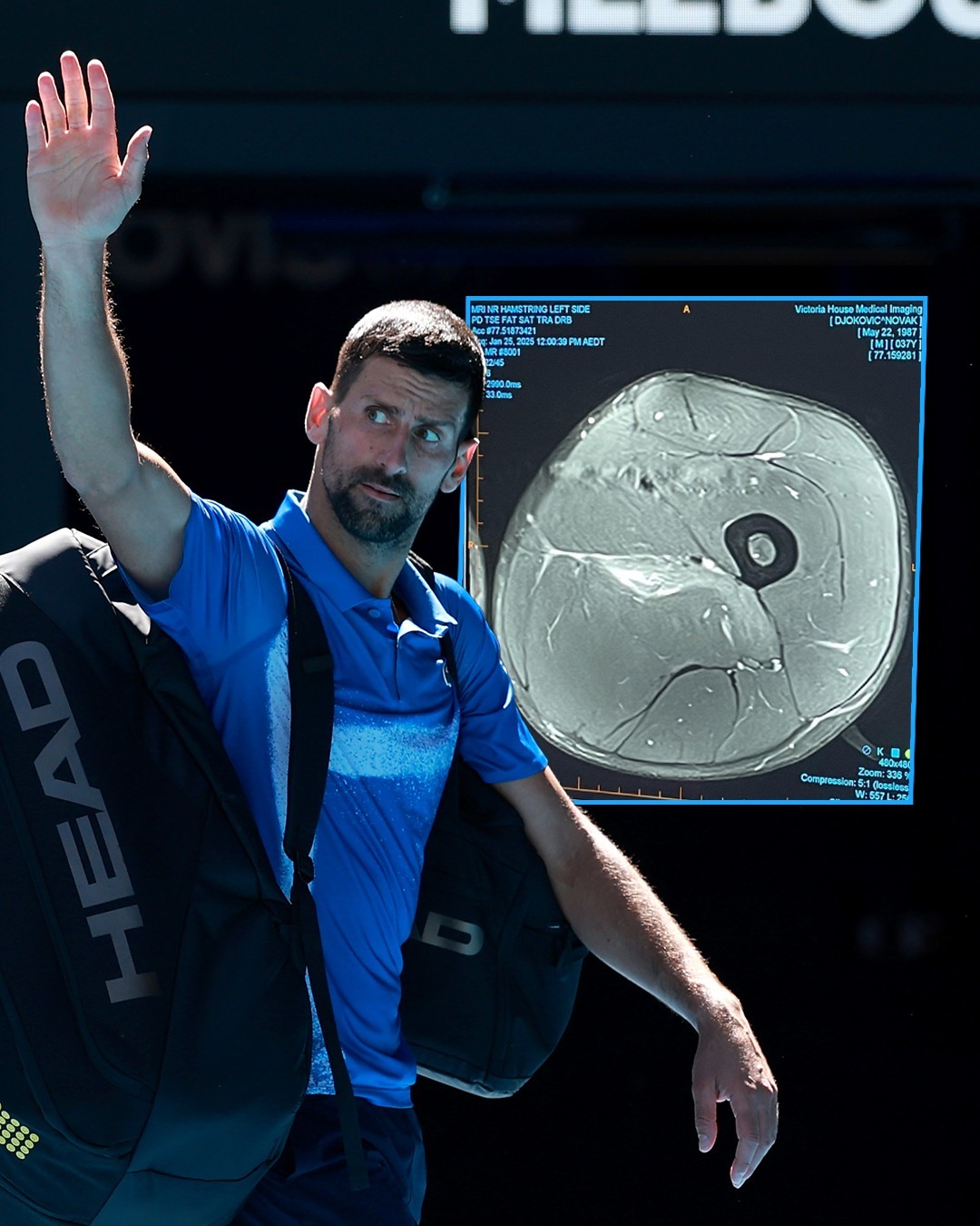 关于英国网球队碾压澳大利亚网球队，德约科维奇爆发神勇的信息